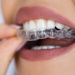 Invisalign services at Modern Dental Associates