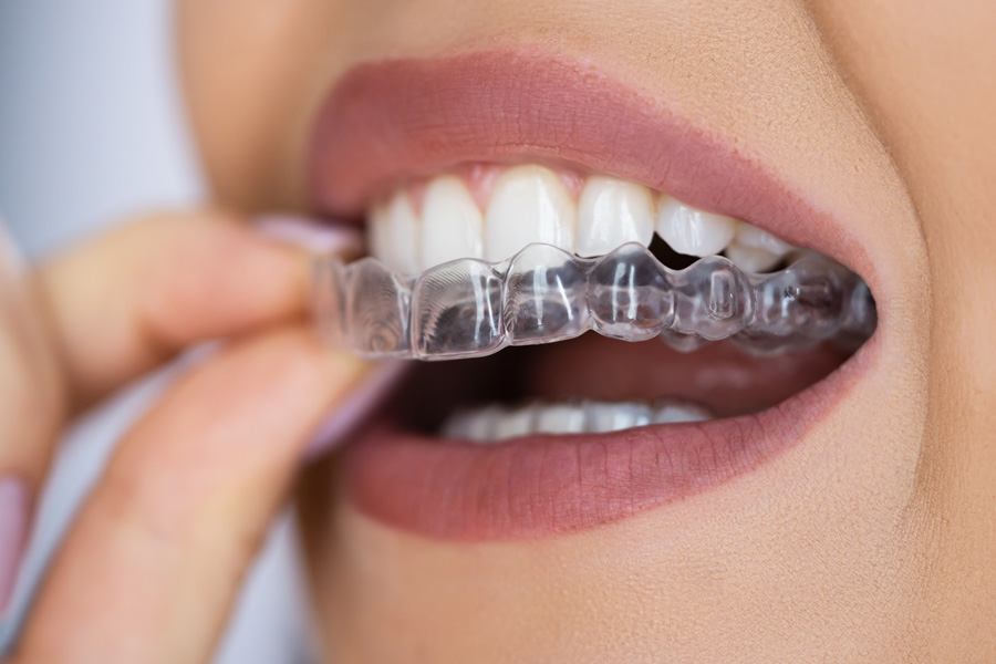 Invisalign services at Modern Dental Associates