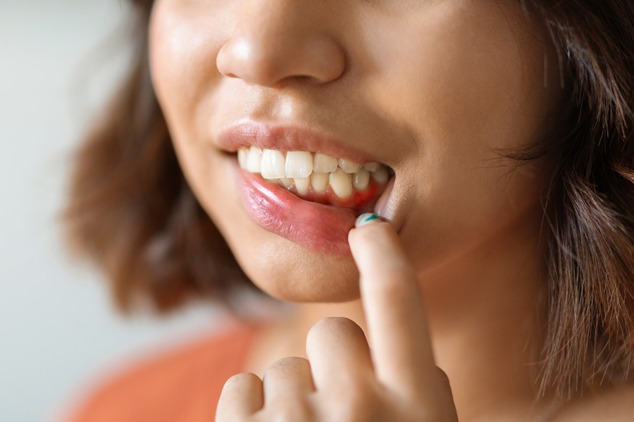 Gum disease can affect anyone.